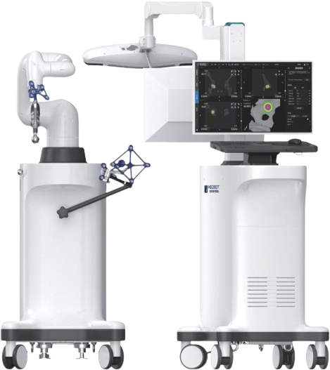 骨科关节置换手术导航定位系统