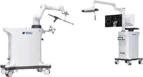 膝关节置换手术导航定位系统