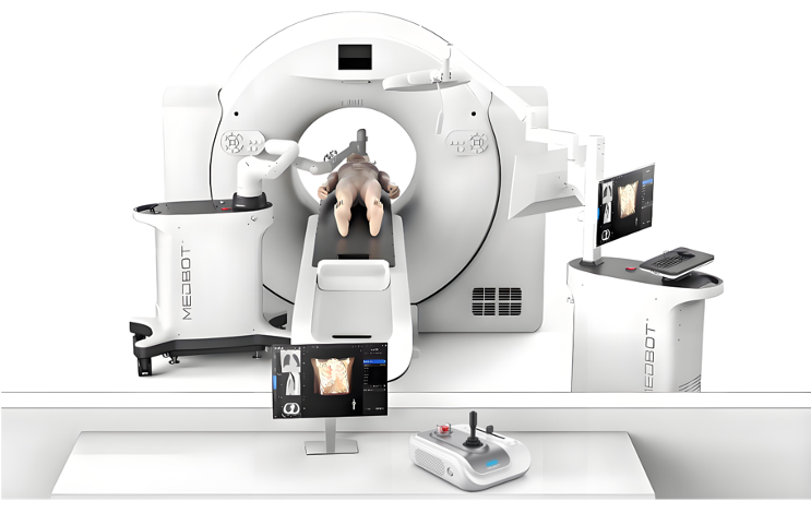 穿刺手术导航定位系统