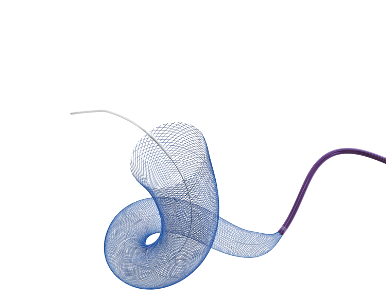 血流导向密网支架