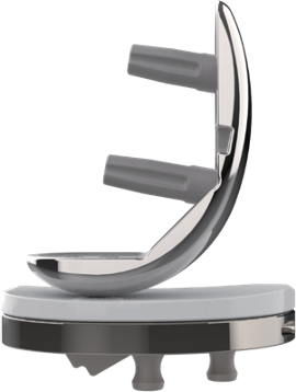 国产单髁膝关节假体