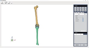 膝关节图像处理软件